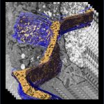 Kỹ thuật kính hiển vi điện tử mới hạn chế phá hủy các protein màng trong một tế bào