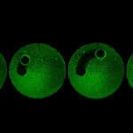 Một đội quân robot siêu nhỏ có thể quét sạch mảng bám răng