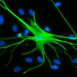 Nghiên cứu về hành vi của giun lặp đi lặp lại có thể có ý nghĩa đối với việc hiểu bệnh của con người