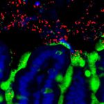 Vi khuẩn đường ruột từ trẻ sơ sinh khỏe mạnh ngăn chặn sự phát triển dị ứng sữa ở chuột