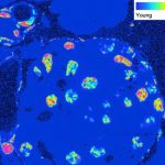 Các nhà khoa học phát hiện ra cấu trúc tế bào với tuổi thọ cực cao, dẫn đến hiểu biết về các bệnh liên quan đến tuổi tác