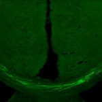 Sửa chữa thành công não chuột khi chúng bị đột quỵ