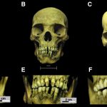 Câu chuyện về ba nô lệ châu Phi trong thời kỳ thực dân Tây Ban Nha, được kể bằng xương của họ