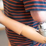 Công nghệ giúp các bệnh nhân điều khiển chân tay giả bằng tâm trí ‘cảm thấy’ như bình thường