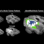 Phương pháp học máy mới cho phép các bệnh viện chia sẻ dữ liệu bệnh nhân – một cách riêng tư